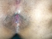 anal in missionary gaping 8/16