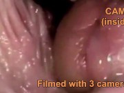 Close-up cum inside pussy 15/16