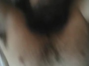 Hairy triple amputee... 1/16