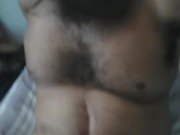 Hairy triple amputee... 11/16