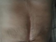 Hairy triple amputee... 2/16