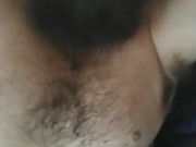 Hairy triple amputee... 5/16
