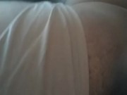 Hairy triple amputee... 9/16