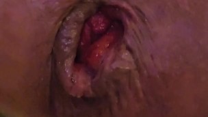 Close up of my asshole being fingered and stretched wide with huge dildo