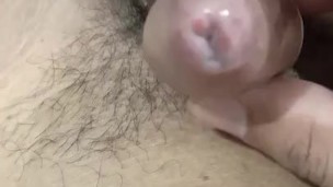Applyime medicine my syphilis (sexual transmitted disease) penis. Getting more swallon on my dick he