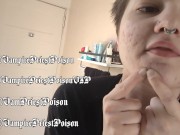 PREVIEW Zit Popping Clip 3 15/16