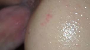 Stretched out pussyStretched out pussy