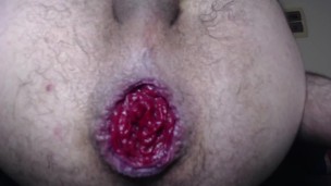 Punch fisting, prolapse and cumming real good