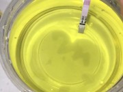 Girl Pissing into a container and plays urine with fingers. 3rd day of ovulation test