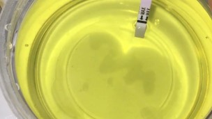 Girl Pissing into a container and plays urine with fingers. 3rd day of ovulation test