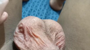Yeast infection and fungus infection treatment. I fucked my fake pussy hole and got the infection.