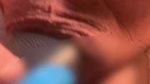 無駄毛処理