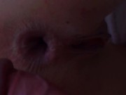 Breaking ass ANAL ! My gape will never close again :) 7/16