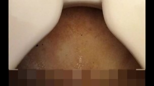Uncircumcised penis pee