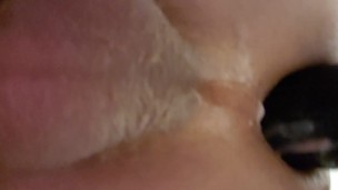 Anal gape close up