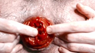 Pushing my prolapse out, fisting and showing closely my asshole