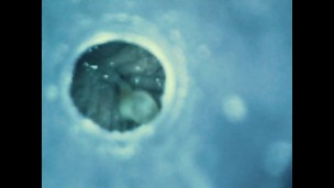 Internal views - Endoscope inside ass , cock , mouth - endoscope anal insertion, urethral insertion