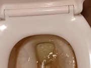 Toilet Pissing 16/16