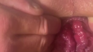 prolapse fun