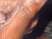 When bored…grab the lotion 5/16