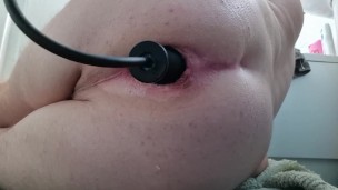 Inflatable butt plug starts my loose ass to prolapse 