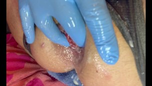 Bombshell Anal Plug 12 inch 💣 Gaping Slut 👻 Addicted To Stretching His Asshole