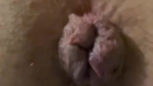 Cloudy Pumped Ass Lips
