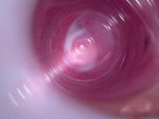 Camera deep inside teen creamy pussy 10/16