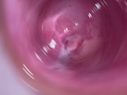 Camera deep inside teen creamy pussy 12/16