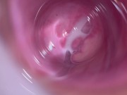 Camera deep inside teen creamy pussy 14/16