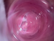 Camera deep inside teen creamy pussy 15/16