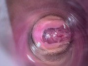 Camera deep inside teen creamy pussy 16/16