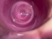 Camera deep inside teen creamy pussy 5/16