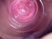 Camera deep inside teen creamy pussy 8/16