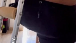 Amputee guy walking and showing his body