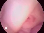 【解剖生理学】超小型カメラで元看護師の私が膣内を観察し紹介します。 14/16