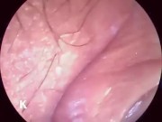 【解剖生理学】超小型カメラで元看護師の私が膣内を観察し紹介します。 15/16