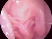 【解剖生理学】超小型カメラで元看護師の私が膣内を観察し紹介します。 16/16