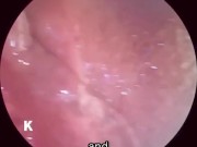 【解剖生理学】超小型カメラで元看護師の私が膣内を観察し紹介します。 2/16