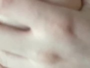 更多yp25.cc 毛毛逐渐长出来啦！！！ 1/16