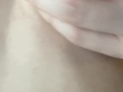 更多yp25.cc 毛毛逐渐长出来啦！！！ 15/16