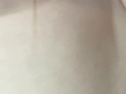 更多yp25.cc 毛毛逐渐长出来啦！！！ 16/16