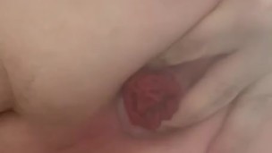 Prolapse after a shower