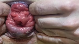 I like to pump my Anal prolapse