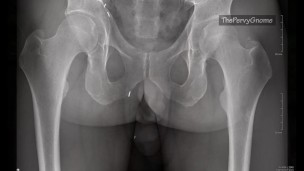 More than skin deep - an x-ray view of my dick!!