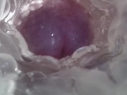 Sweet creampie in vagina. Super internal camera 9/16