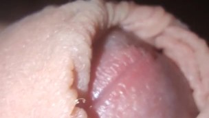 Foreskin