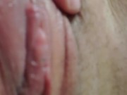 MY POOR PUSSY!! My VCH Piercing Ripped my Hood in Half, i had to go to the ER and get a Stitch! 14/16