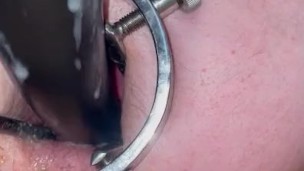 my new speculum opens my hungry ass! this long dildo made my prolapse fart