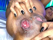 flexi milf prolapse her anus while she gets ass fucked